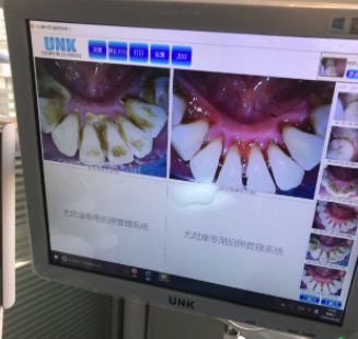 山西阳泉康雅口腔医院洗牙 山西阳泉康雅口腔医院洗牙
