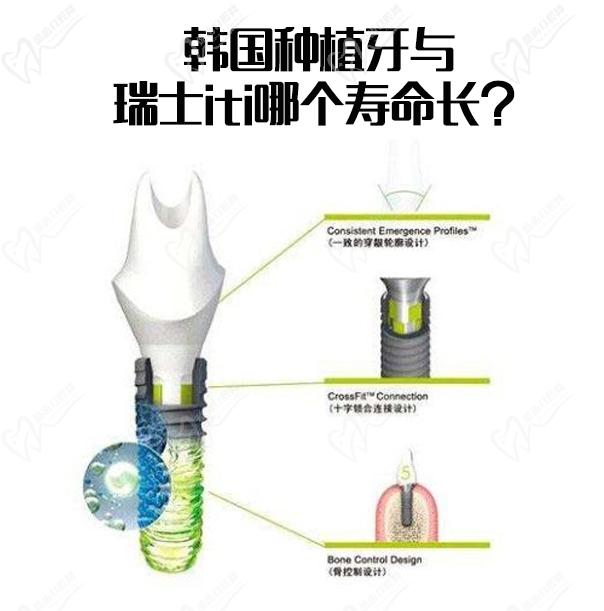 韩国种植牙与瑞士iti哪个寿命长原来区别在这可不止价格
