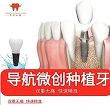 杭州民利口腔瑞典诺贝尔种植牙仅需22500元起，口腔CT高效可靠