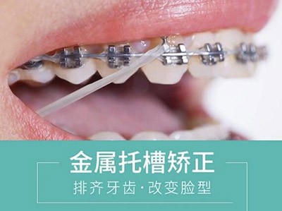 东莞固德口腔牙齿矫正怎么样？金属托槽矫正技术好仅需6千起