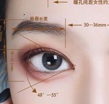 ​北京丽星翼美眼修复中心价格表！魏志香双眼皮眼修复2.8w起-内眼角修复2.3w起