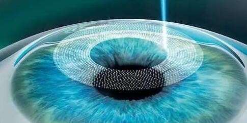 武汉佰视佳眼科医院治疗近视拿手,可预约周跃明个性化半飞11500元起