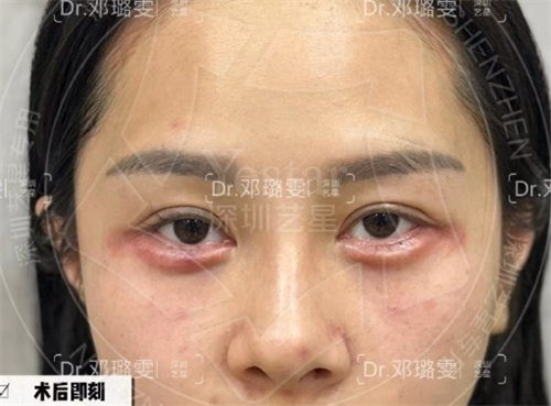 深圳艺星邓璐雯打针蛮好的,气质微整经验多审美也很绝2w起