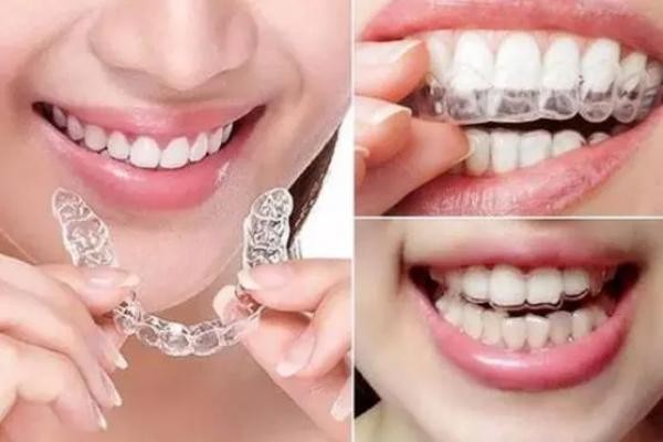 福州维乐口腔隐适美全隐形矫正33000元起，郭淑苹隐形矫正很拿手
