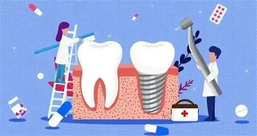 汕头益珺口腔门诊部林秋君高龄老人牙齿种植3031元起，医生技术很不错