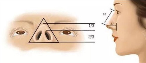 合肥维多利亚徐和林做鼻子确实不赖，维密鼻综合13000元起好看稳定