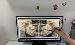 北京齿康口腔门诊部牙片