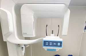 德州大美口腔门诊部CBCT机 德州大美口腔门诊部CBCT机