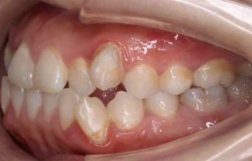 天津赛德阳光口腔牙齿矫正 天津赛德阳光口腔牙齿矫正