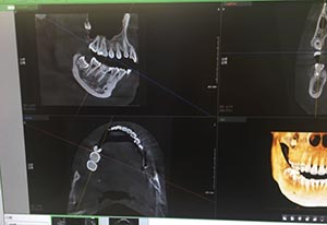 临沂瑞丽口腔牙片