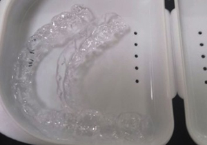 隐形牙齿矫正牙套