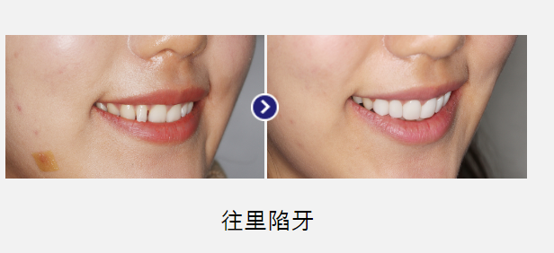 韩国今日安MINISH牙科医院