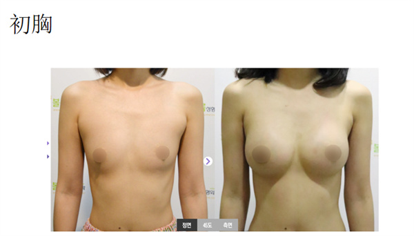 韩国波轮美整形医院