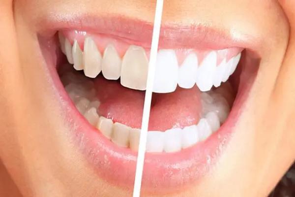 北京皓尔佳艺口腔门诊部高宇轩医生