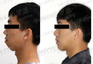 1733478708375804.png image.png