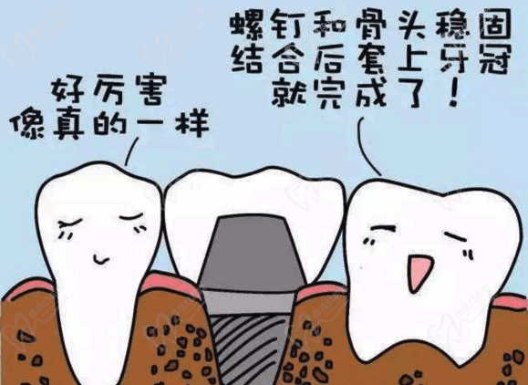 北京中诺口腔柯松林牙齿矫正效果好吗？