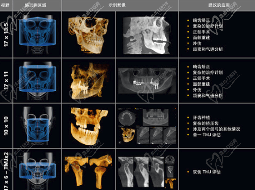 数字成像系统