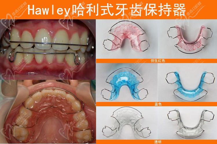 保持器