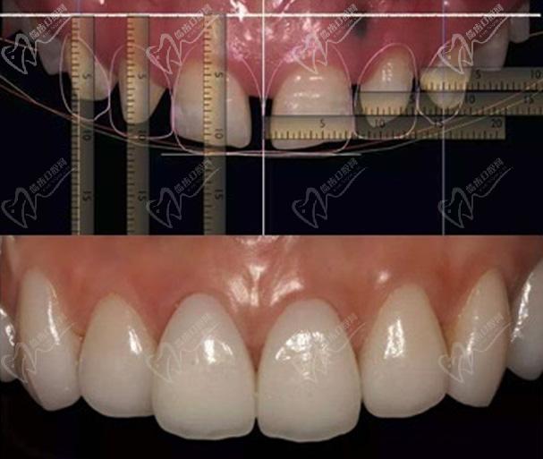 深圳福华口腔医院数字化修复技术
