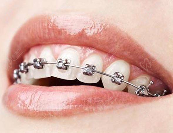 重庆牙博士口腔医院牙齿矫正科