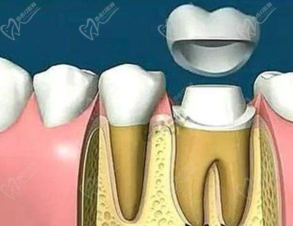 重庆牙博士口腔医院牙齿治疗科