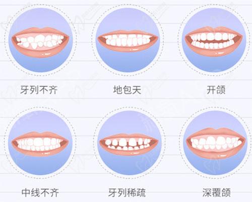 不良习惯会导致的牙齿问题