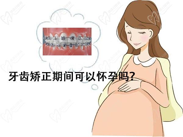 牙齿矫正期间可以怀孕吗？