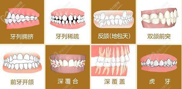 18岁后：恒牙期，牙齿矫正没有时间限制