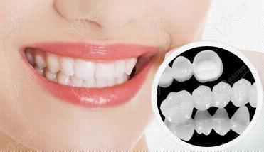 常德美奥口腔牙齿美白修复优惠活动