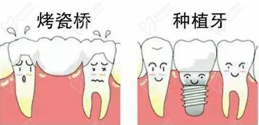 上海松丰齿科种植牙怎么样