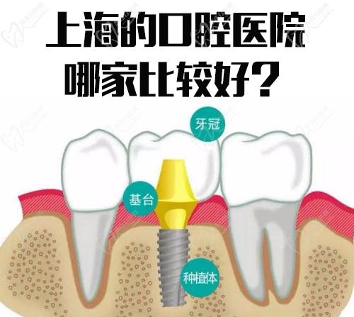 上海的口腔医院哪家比较好？