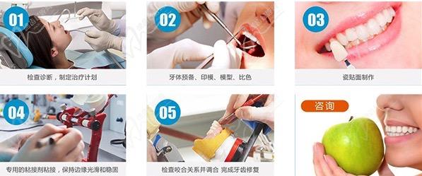 福州爱尚贝臣口腔门诊部特色项目牙齿美学修复
