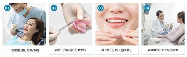 福州爱尚贝臣口腔门诊部特色项目牙齿矫正