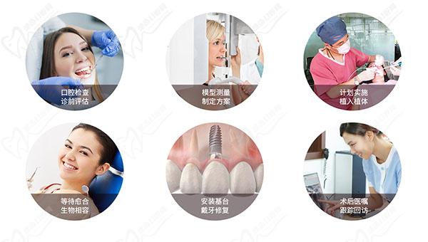 雅悦齿科种植流程