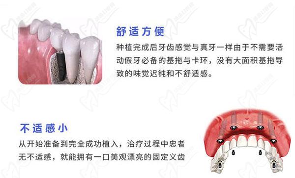 数字化种植技术优势