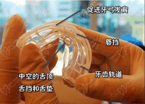 成都团圆口腔MRC儿童早期矫正