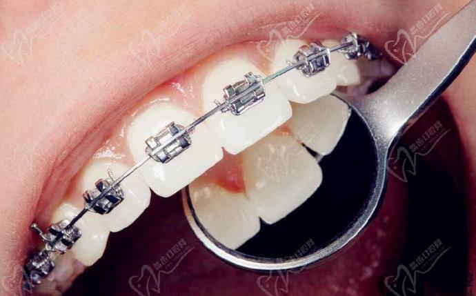 天津瑞景口腔门诊部牙齿矫正