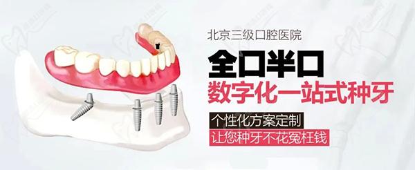 北京中诺口腔医院种植牙价目表（包含全口牙价格）