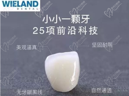 威兰德全瓷牙 威兰德全瓷牙