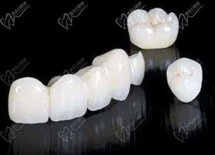 威兰德全瓷牙 威兰德全瓷牙