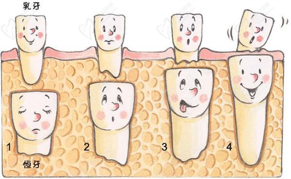 怎么区分乳牙和恒牙