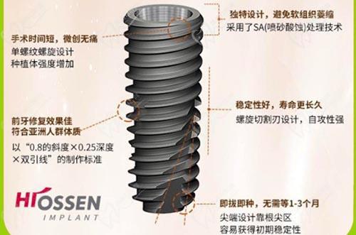 皓圣种植牙优势