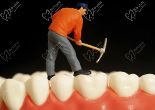 修复牙齿