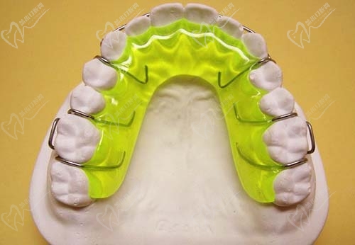 牙齿保持器模型