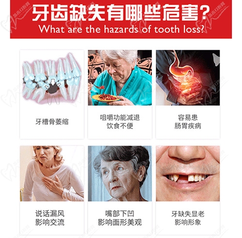 牙齿缺失的危害