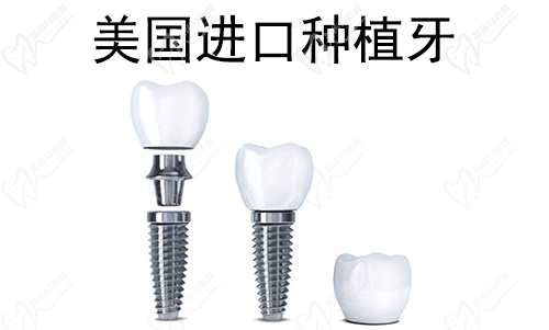 上海雅悦齿科美国进口种植牙