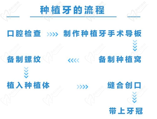 成都东篱医院口腔科种植牙流程