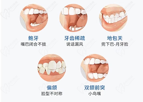 牙齿畸形情况