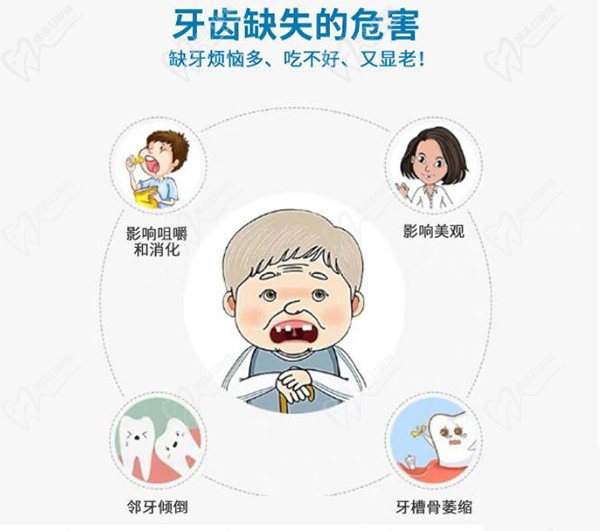 牙齿缺失的危害你知道吗