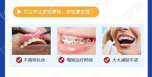 南京润玺口腔矫正优势